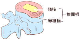 椎間板は髄核と線維輪から成る