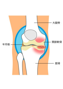 hizaoa3